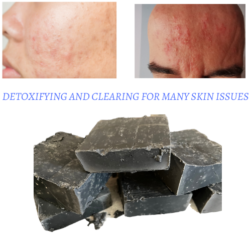 Charcoal and Sea Salt Soap